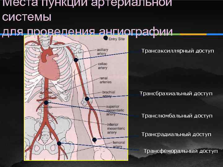 Места пункции артериальной системы для проведения ангиографии ● Трансаксиллярный доступ ● Трансбрахиальный доступ ●