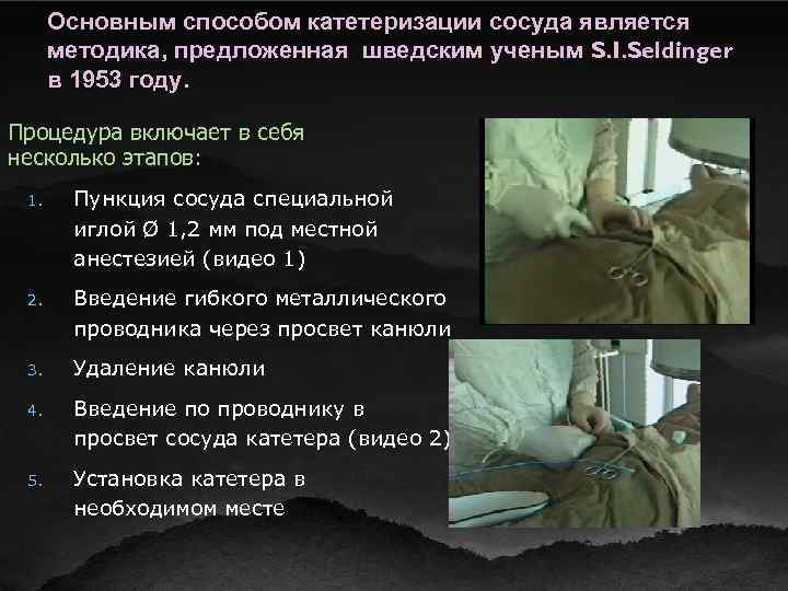 Основным способом катетеризации сосуда является методика, предложенная шведским ученым S. I. Seldinger в 1953