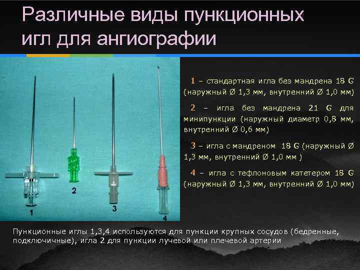 Различные виды пункционных игл для ангиографии 1 – стандартная игла без мандрена 18 G