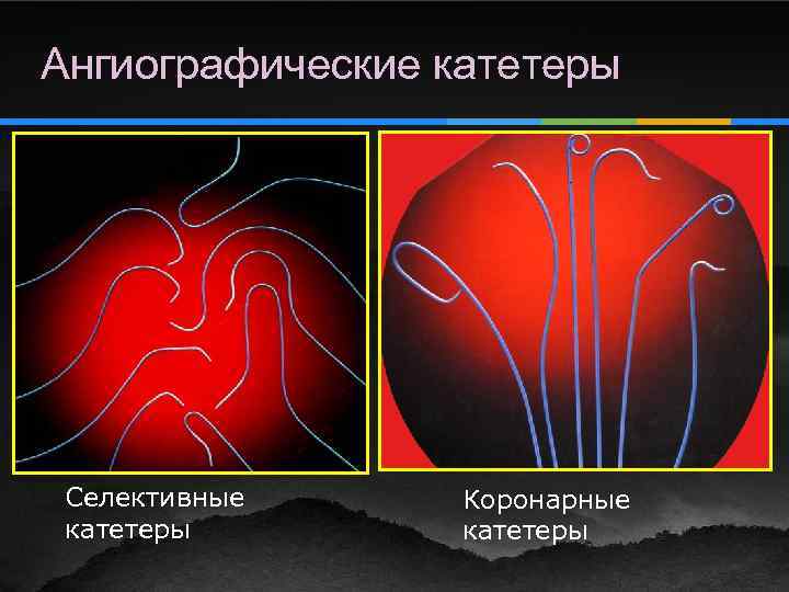 Ангиографические катетеры Селективные катетеры Коронарные катетеры 