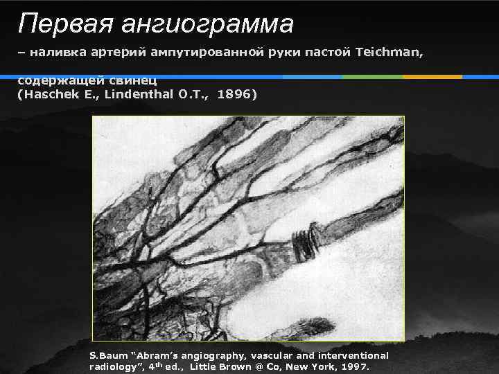 Первая ангиограмма – наливка артерий ампутированной руки пастой Teichman, содержащей свинец (Haschek E. ,