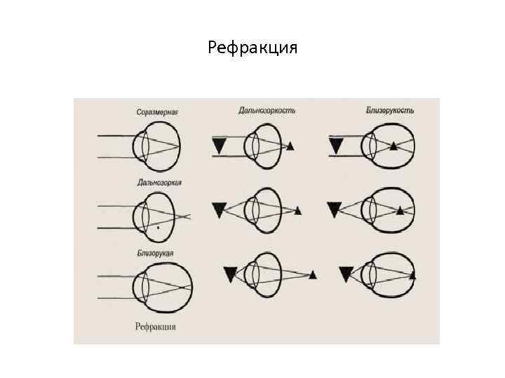 Рефракция 