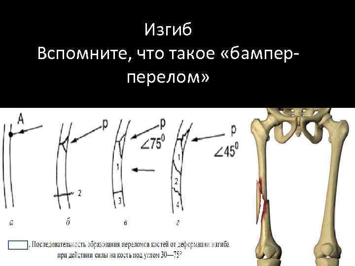 Изгиб Вспомните, что такое «бамперперелом» 