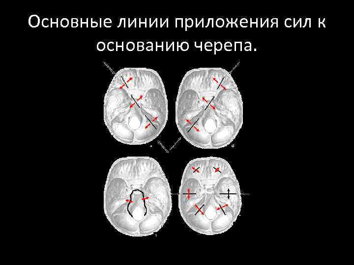 Основные линии приложения сил к основанию черепа. 