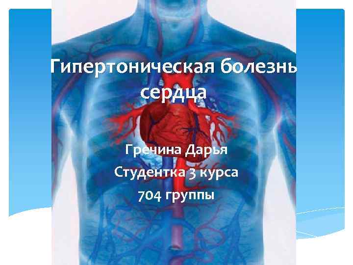 Гипертоническая болезнь сердца Гречина Дарья Студентка 3 курса 704 группы 