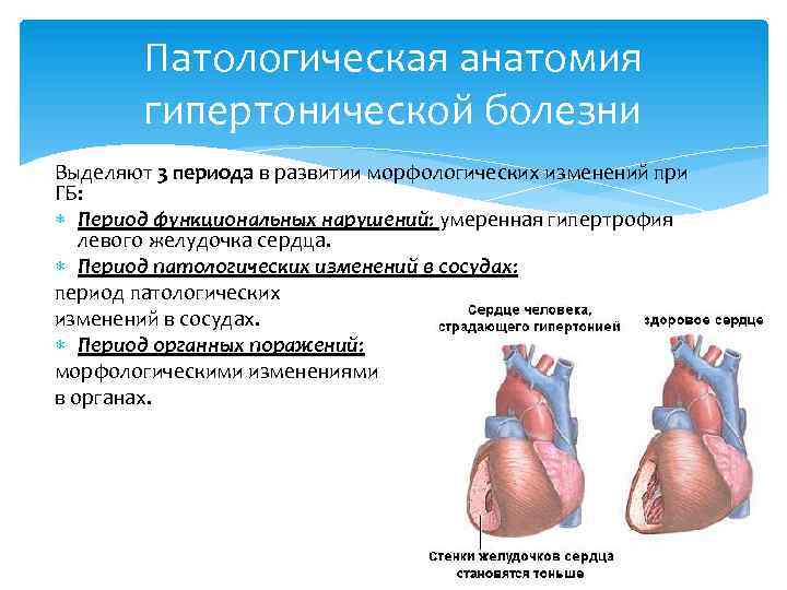 Патанатомия гипертоническая болезнь презентация