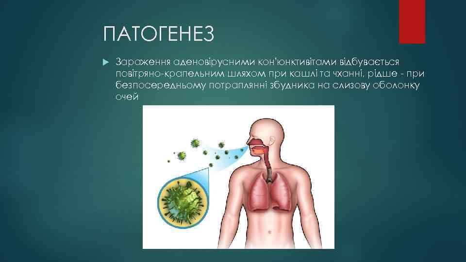 ПАТОГЕНЕЗ Зараження аденовірусними кон'юнктивітами відбувається повітряно-крапельним шляхом при кашлі та чханні, рідше - при