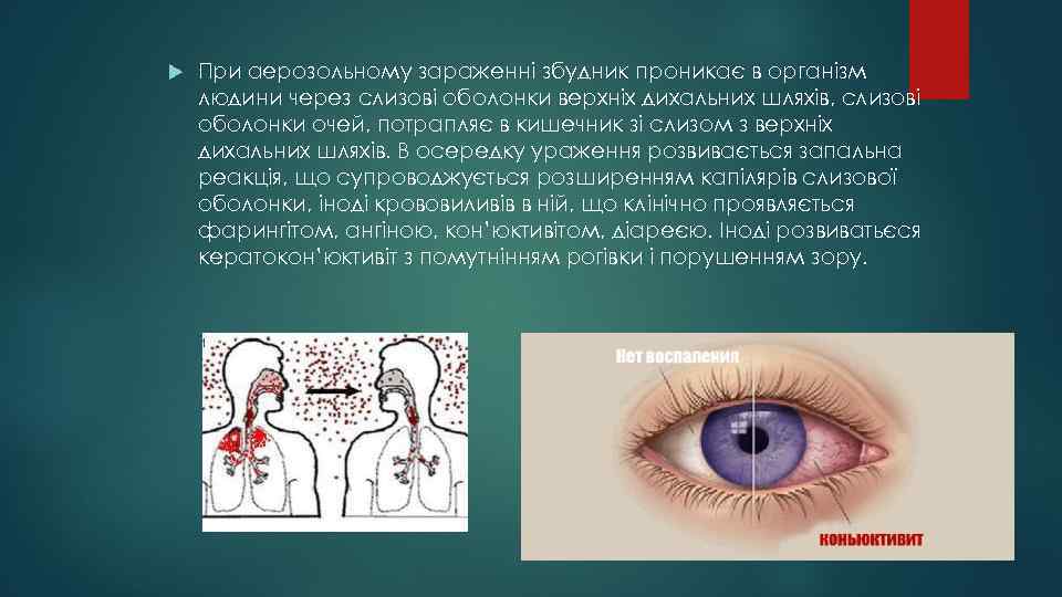  При аерозольному зараженні збудник проникає в організм людини через слизові оболонки верхніх дихальних