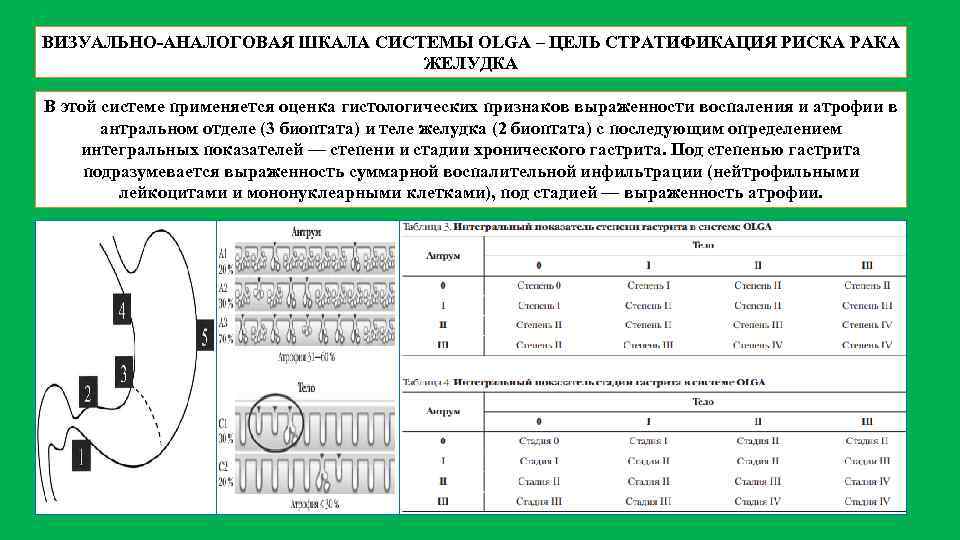 ВИЗУАЛЬНО АНАЛОГОВАЯ ШКАЛА СИСТЕМЫ OLGA – ЦЕЛЬ СТРАТИФИКАЦИЯ РИСКА РАКА ЖЕЛУДКА В этой системе