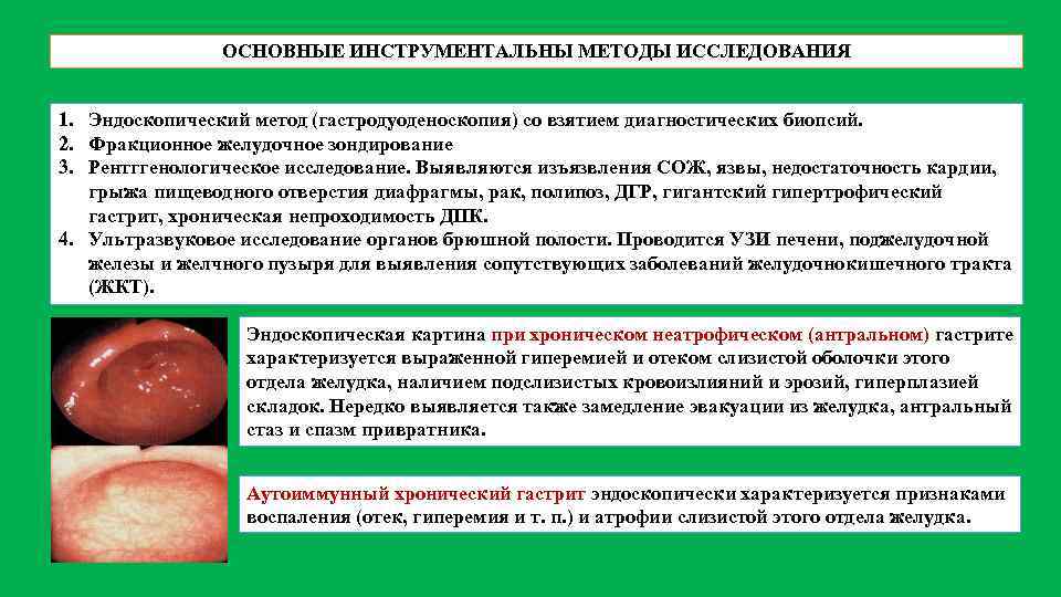 ОСНОВНЫЕ ИНСТРУМЕНТАЛЬНЫ МЕТОДЫ ИССЛЕДОВАНИЯ 1. Эндоскопический метод (гастродуоденоскопия) со взятием диагностических биопсий. 2. Фракционное