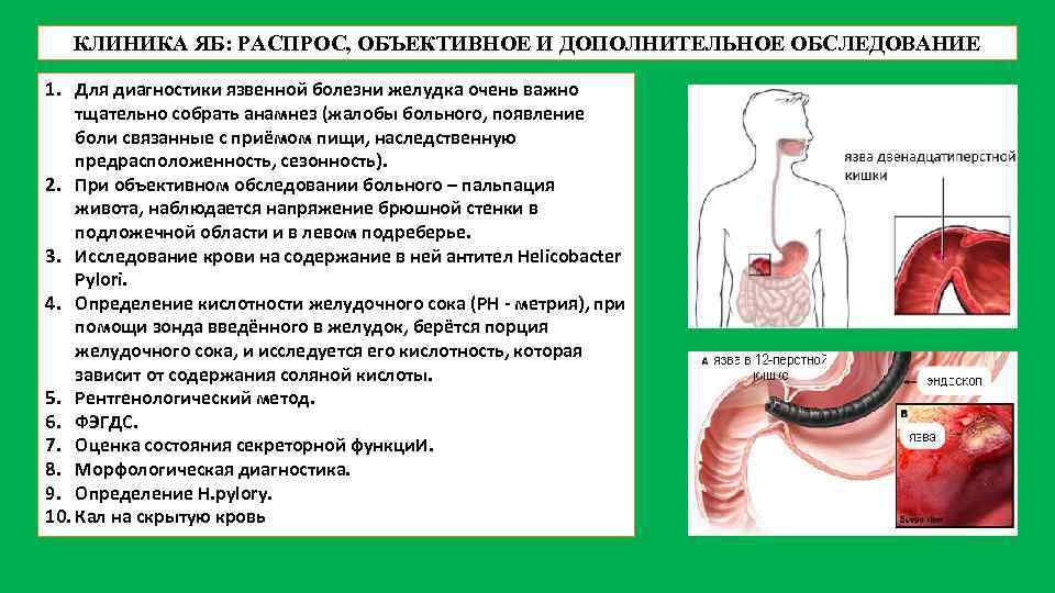 КЛИНИКА ЯБ: РАСПРОС, ОБЪЕКТИВНОЕ И ДОПОЛНИТЕЛЬНОЕ ОБСЛЕДОВАНИЕ 1. Для диагностики язвенной болезни желудка очень