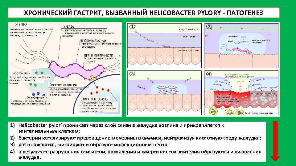 ХРОНИЧЕСКИЙ ГАСТРИТ, ВЫЗВАННЫЙ HELICOBACTER PYLORY - ПАТОГЕНЕЗ 1) Helicobacter pylori проникает через слой слизи