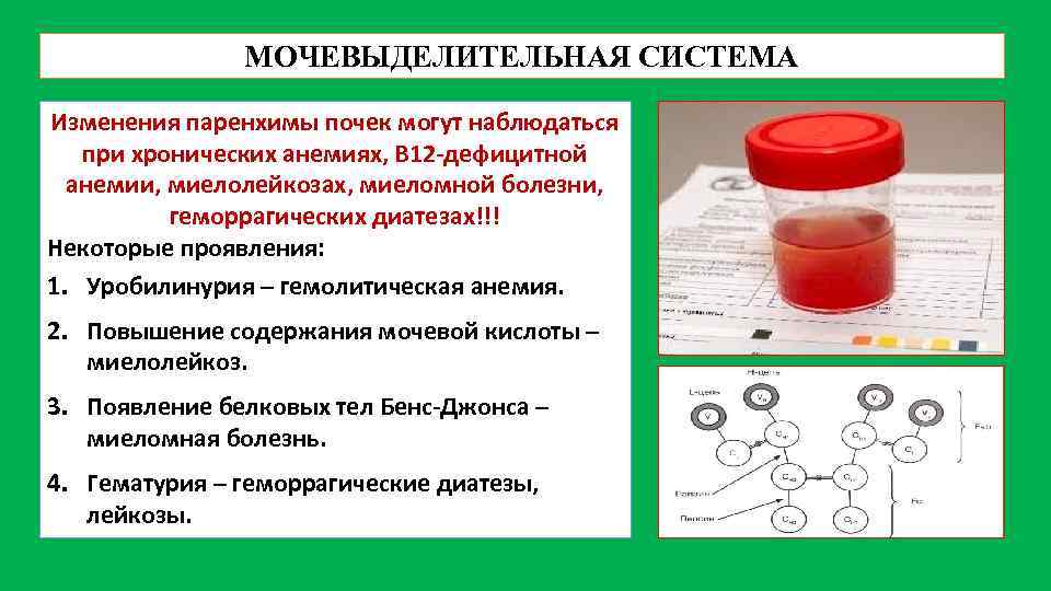 МОЧЕВЫДЕЛИТЕЛЬНАЯ СИСТЕМА Изменения паренхимы почек могут наблюдаться при хронических анемиях, В 12 -дефицитной анемии,
