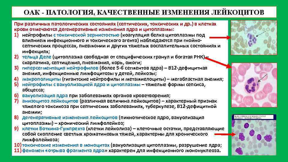 ОАК - ПАТОЛОГИЯ, КАЧЕСТВЕННЫЕ ИЗМЕНЕНИЯ ЛЕЙКОЦИТОВ При различных патологических состояниях (септических, токсических и др.