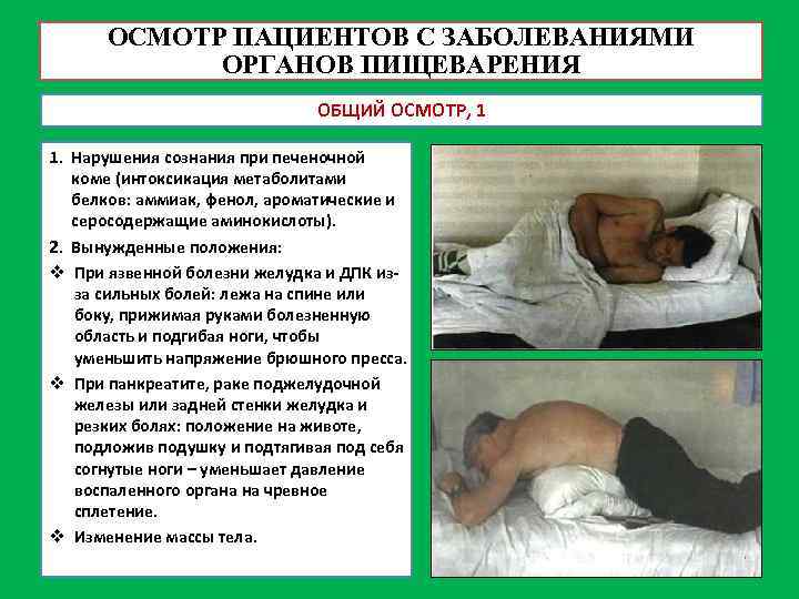ОСМОТР ПАЦИЕНТОВ С ЗАБОЛЕВАНИЯМИ ОРГАНОВ ПИЩЕВАРЕНИЯ ОБЩИЙ ОСМОТР, 1 1. Нарушения сознания при печеночной