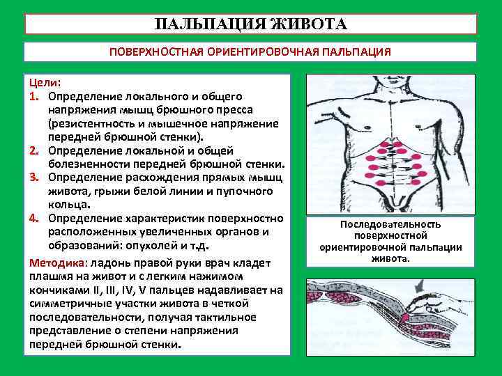 ПАЛЬПАЦИЯ ЖИВОТА ПОВЕРХНОСТНАЯ ОРИЕНТИРОВОЧНАЯ ПАЛЬПАЦИЯ Цели: 1. Определение локального и общего напряжения мышц брюшного