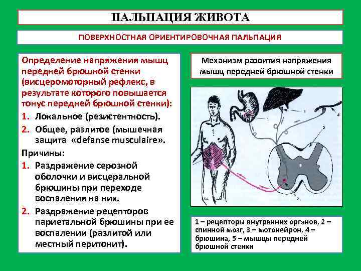 ПАЛЬПАЦИЯ ЖИВОТА ПОВЕРХНОСТНАЯ ОРИЕНТИРОВОЧНАЯ ПАЛЬПАЦИЯ Определение напряжения мышц передней брюшной стенки (висцеромоторный рефлекс, в