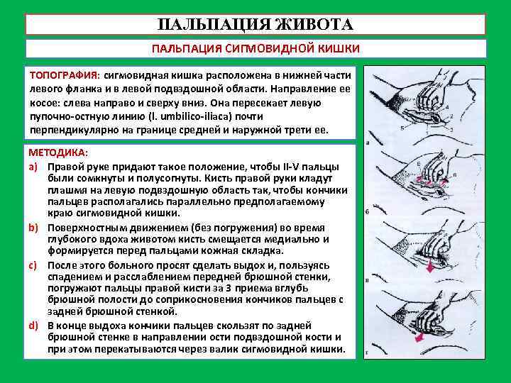 ПАЛЬПАЦИЯ ЖИВОТА ПАЛЬПАЦИЯ СИГМОВИДНОЙ КИШКИ ТОПОГРАФИЯ: сигмовидная кишка расположена в нижней части левого фланка