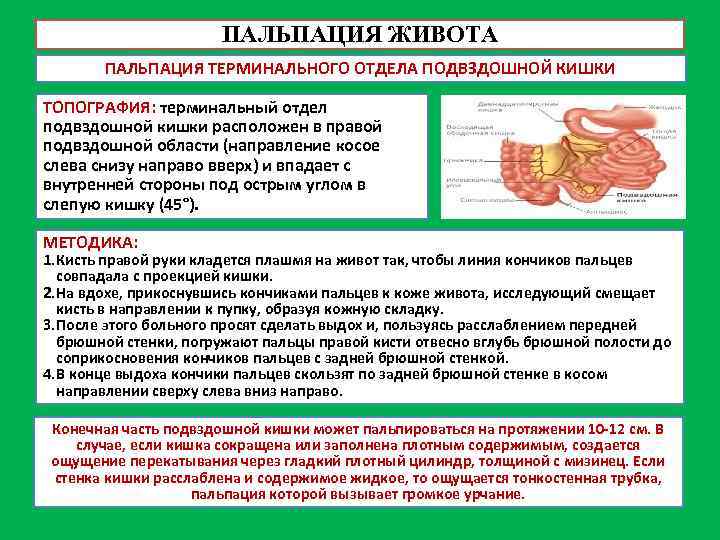 ПАЛЬПАЦИЯ ЖИВОТА ПАЛЬПАЦИЯ ТЕРМИНАЛЬНОГО ОТДЕЛА ПОДВЗДОШНОЙ КИШКИ ТОПОГРАФИЯ: терминальный отдел подвздошной кишки расположен в