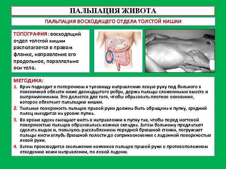 ПАЛЬПАЦИЯ ЖИВОТА ПАЛЬПАЦИЯ ВОСХОДЯЩЕГО ОТДЕЛА ТОЛСТОЙ КИШКИ ТОПОГРАФИЯ: восходящий отдел толстой кишки располагается в