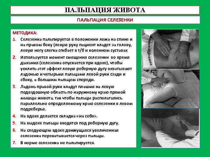 ПАЛЬПАЦИЯ ЖИВОТА ПАЛЬПАЦИЯ СЕЛЕЗЕНКИ МЕТОДИКА: 1. Селезенка пальпируется в положении лежа на спине и