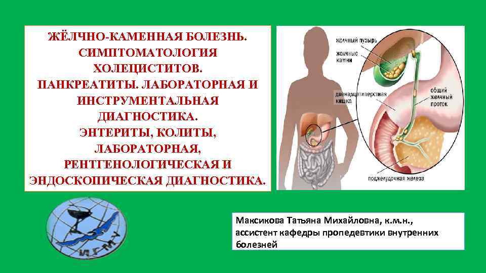 ЖЁЛЧНО-КАМЕННАЯ БОЛЕЗНЬ. СИМПТОМАТОЛОГИЯ ХОЛЕЦИСТИТОВ. ПАНКРЕАТИТЫ. ЛАБОРАТОРНАЯ И ИНСТРУМЕНТАЛЬНАЯ ДИАГНОСТИКА. ЭНТЕРИТЫ, КОЛИТЫ, ЛАБОРАТОРНАЯ, РЕНТГЕНОЛОГИЧЕСКАЯ И