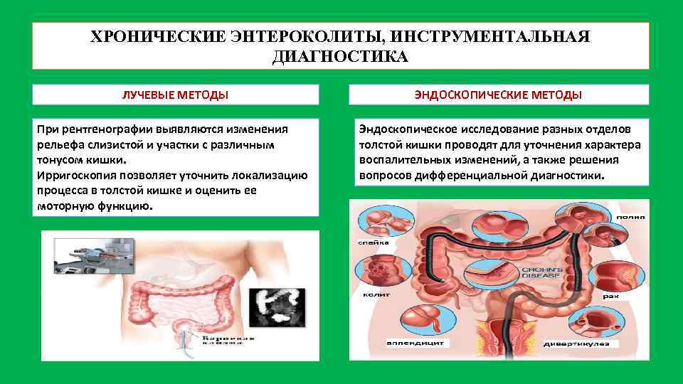 ХРОНИЧЕСКИЕ ЭНТЕРОКОЛИТЫ, ИНСТРУМЕНТАЛЬНАЯ ДИАГНОСТИКА ЛУЧЕВЫЕ МЕТОДЫ ЭНДОСКОПИЧЕСКИЕ МЕТОДЫ При рентгенографии выявляются изменения рельефа слизистой