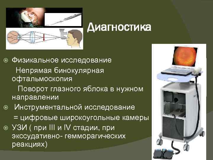 Диагностика Физикальное исследование Непрямая бинокулярная офтальмоскопия Поворот глазного яблока в нужном направлении Инструментальной исследование