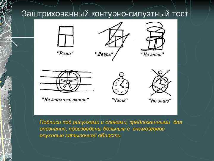 Заштрихованный контурно-силуэтный тест Подписи под рисунками и словами, предложенными для опознания, произведены больным с