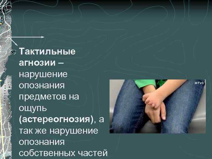 Тактильные агнозии – нарушение опознания предметов на ощупь (астереогнозия), а так же нарушение опознания