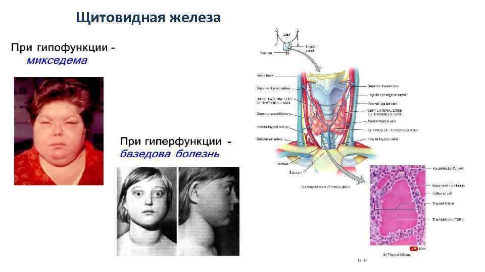 Щитовидная железа 