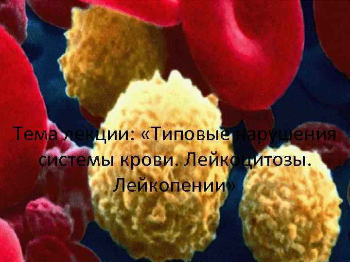 Тема лекции: «Типовые нарушения системы крови. Лейкоцитозы. Лейкопении» 