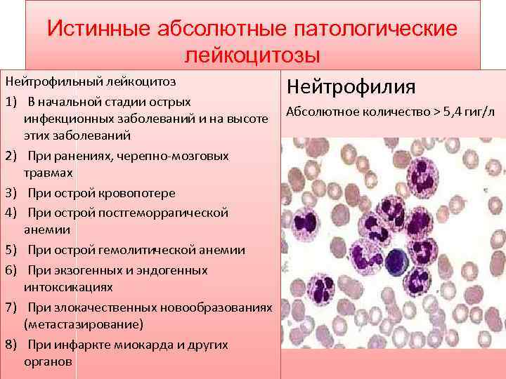 Истинные абсолютные патологические лейкоцитозы Нейтрофильный лейкоцитоз Нейтрофилия 1) В начальной стадии острых инфекционных заболеваний