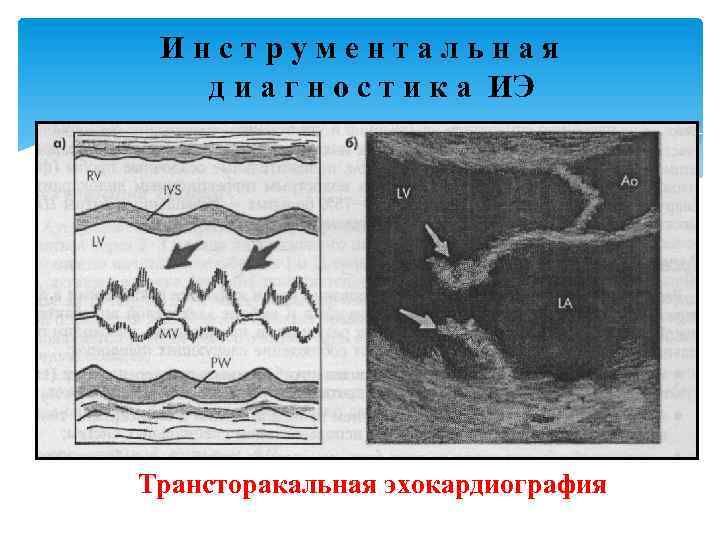 И н с т р у м е н т а л ь н