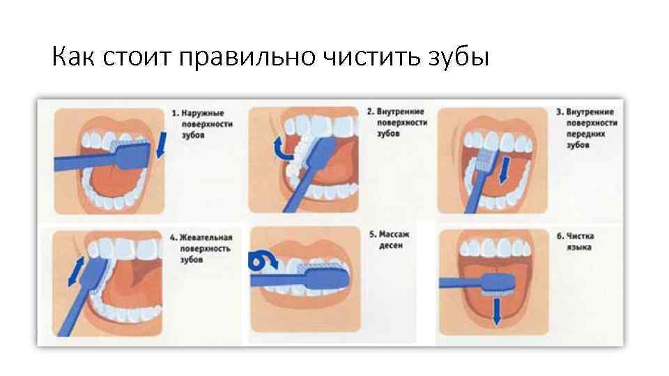 Как стоит правильно чистить зубы 