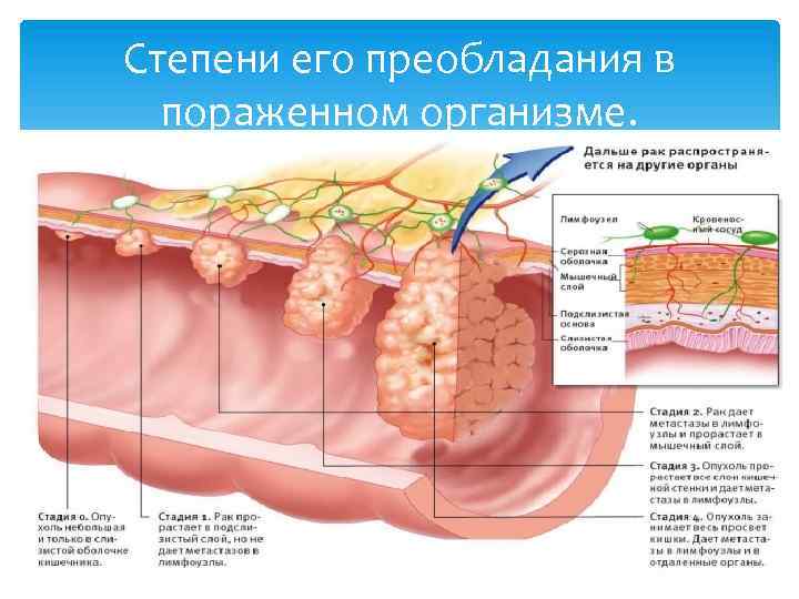 Степени его преобладания в пораженном организме. 