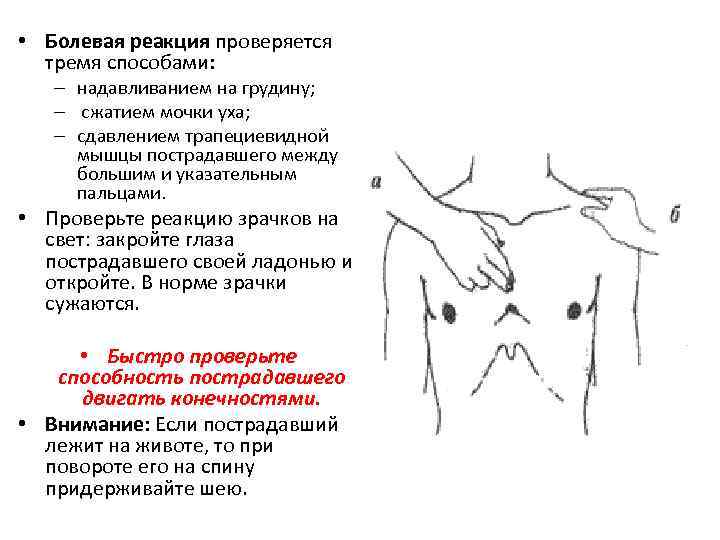 • Болевая реакция проверяется тремя способами: – надавливанием на грудину; – сжатием мочки