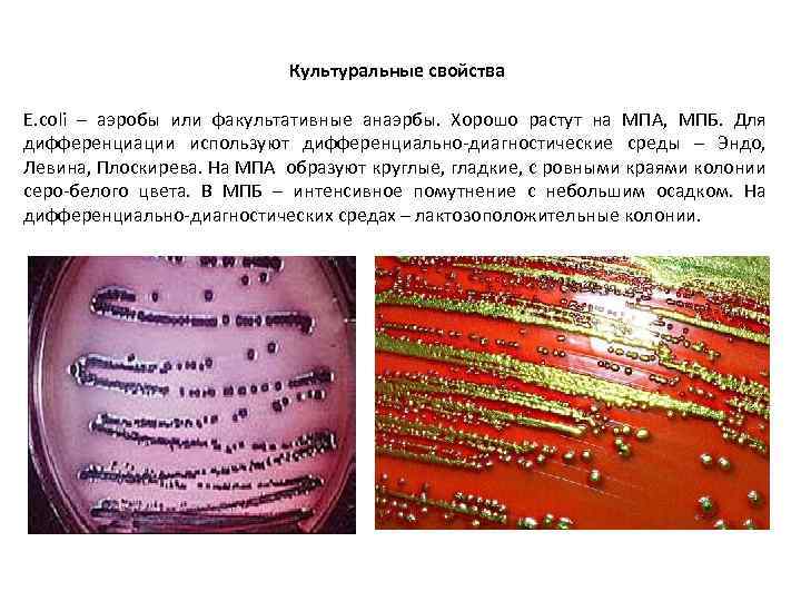 Культуральные свойства E. coli – аэробы или факультативные анаэрбы. Хорошо растут на МПА, МПБ.