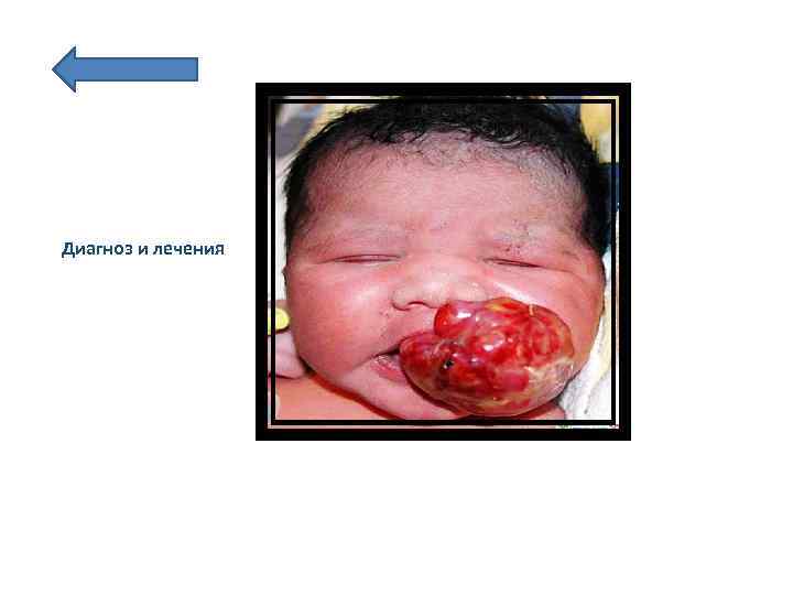 Диагноз и лечения 