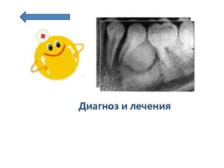 Диагноз и лечения 