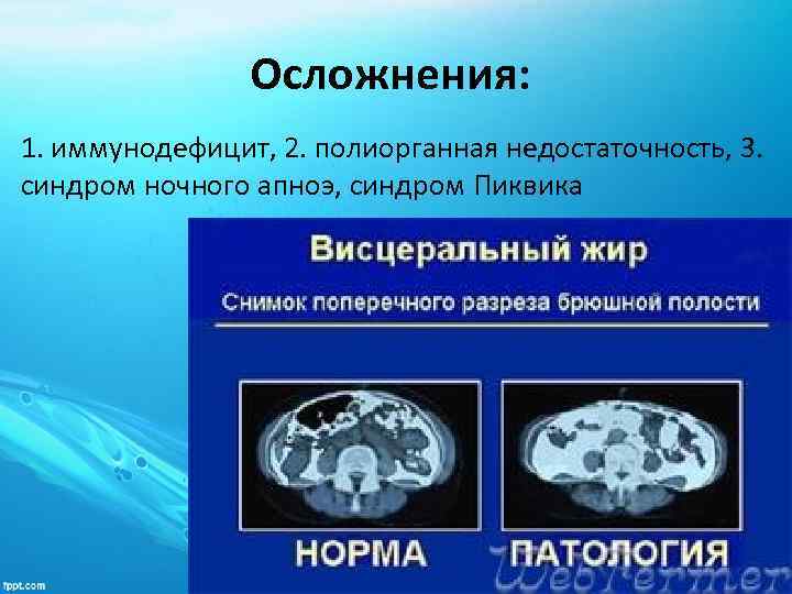 Осложнения: 1. иммунодефицит, 2. полиорганная недостаточность, 3. синдром ночного апноэ, синдром Пиквика 