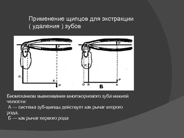 Щипцы для удаления зубов нижней челюсти с названиями и фото