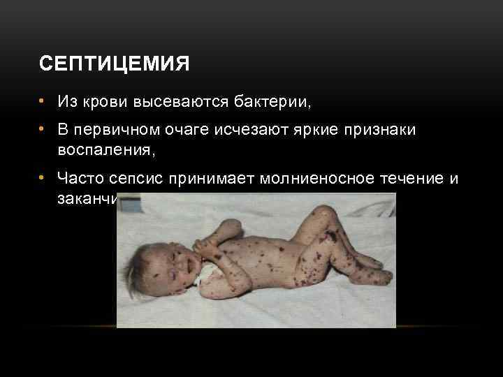 СЕПТИЦЕМИЯ • Из крови высеваются бактерии, • В первичном очаге исчезают яркие признаки воспаления,