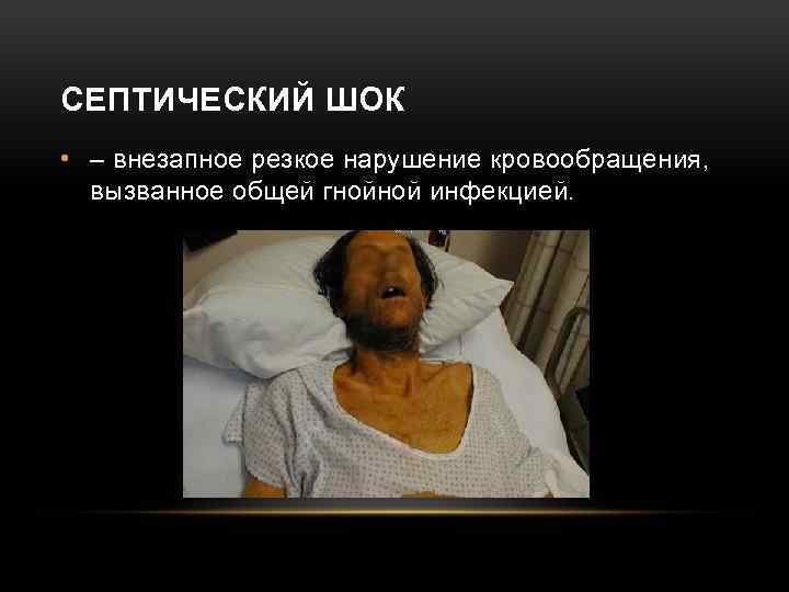 СЕПТИЧЕСКИЙ ШОК • – внезапное резкое нарушение кровообращения, вызванное общей гнойной инфекцией. 