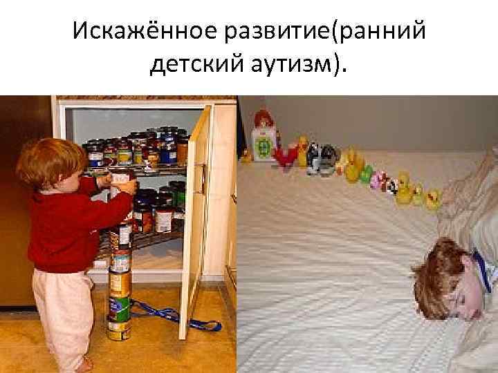 Искаженное развитие