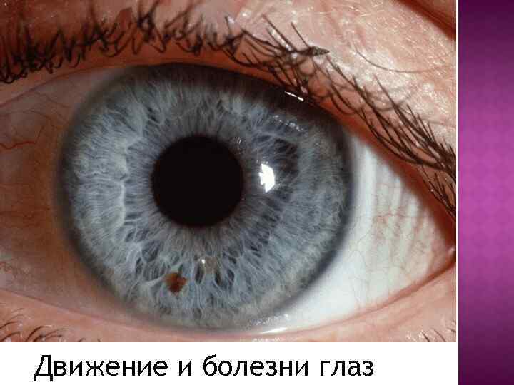Движение и болезни глаз 