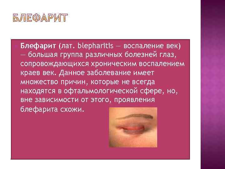  Блефарит (лат. blepharitis — воспаление век) — большая группа различных болезней глаз, сопровождающихся