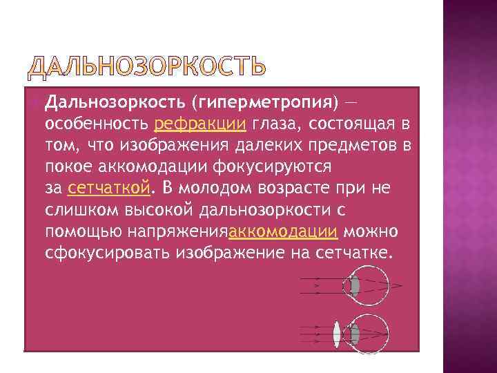  Дальнозоркость (гиперметропия) — особенность рефракции глаза, состоящая в том, что изображения далеких предметов
