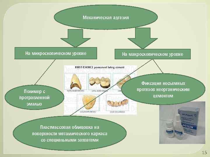 Механическая адгезия На микроскопическом уровне Полимер с протравленной эмалью На макроскопическом уровне Фиксация несъемных