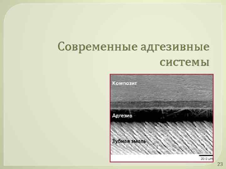 Современные адгезивные системы 23 